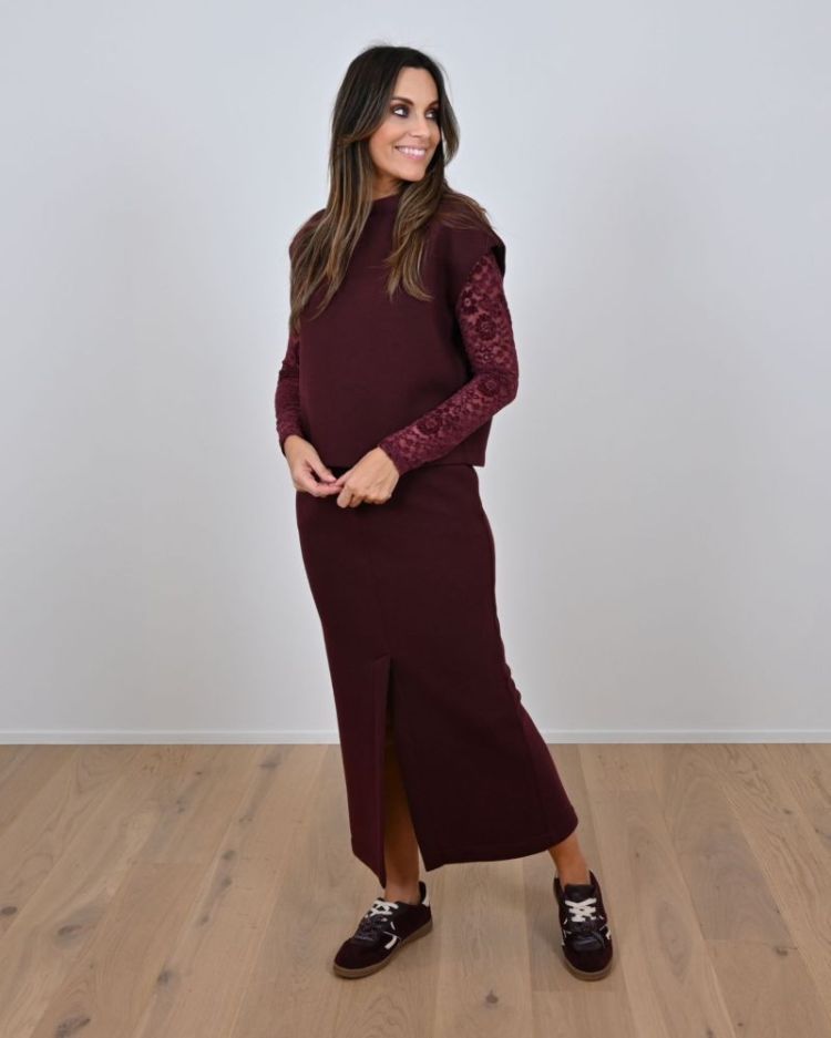 SCARA Bordeaux